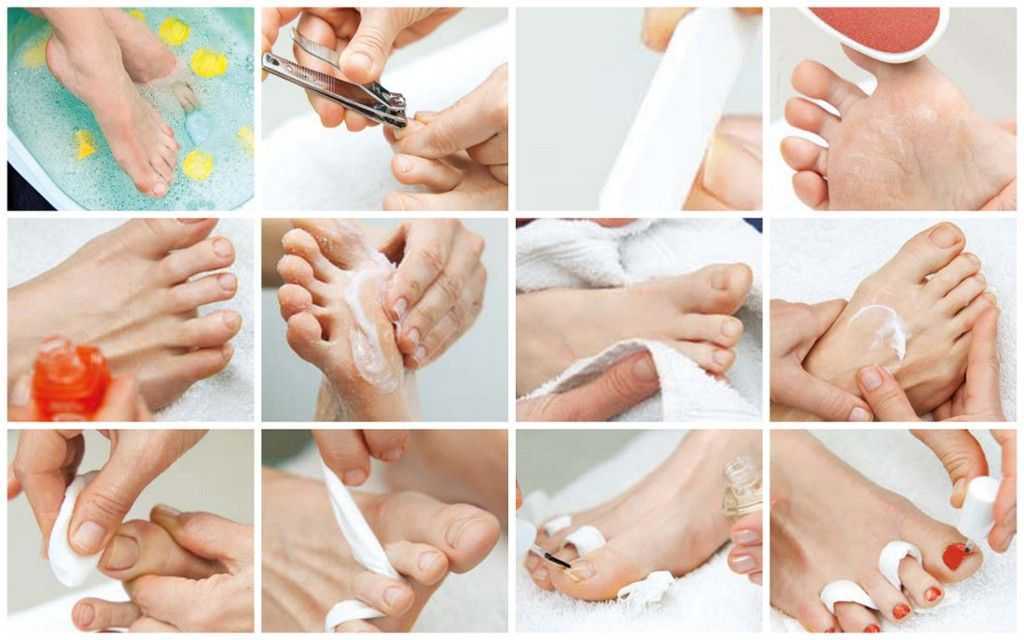 Как правильно делать педикюр в домашних условия своими руками: пошаговое описание процедуры