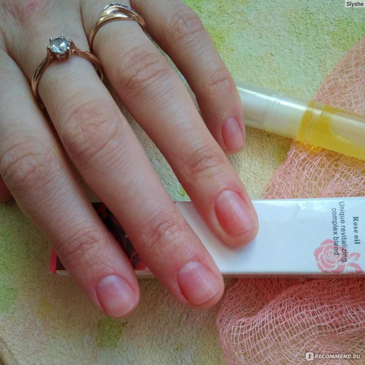 Масляные составы необходимы для кожи рук и ногтей, а кутикула нуждается в отдельном уходе Какое масло лучше использовать для кутикулы Как пользоваться средствами на основе масла и почему следует ухаживать за кожей вокруг ногтей