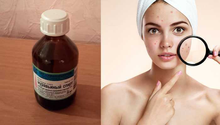 Миндальное масло: полезные свойства для кожи лица