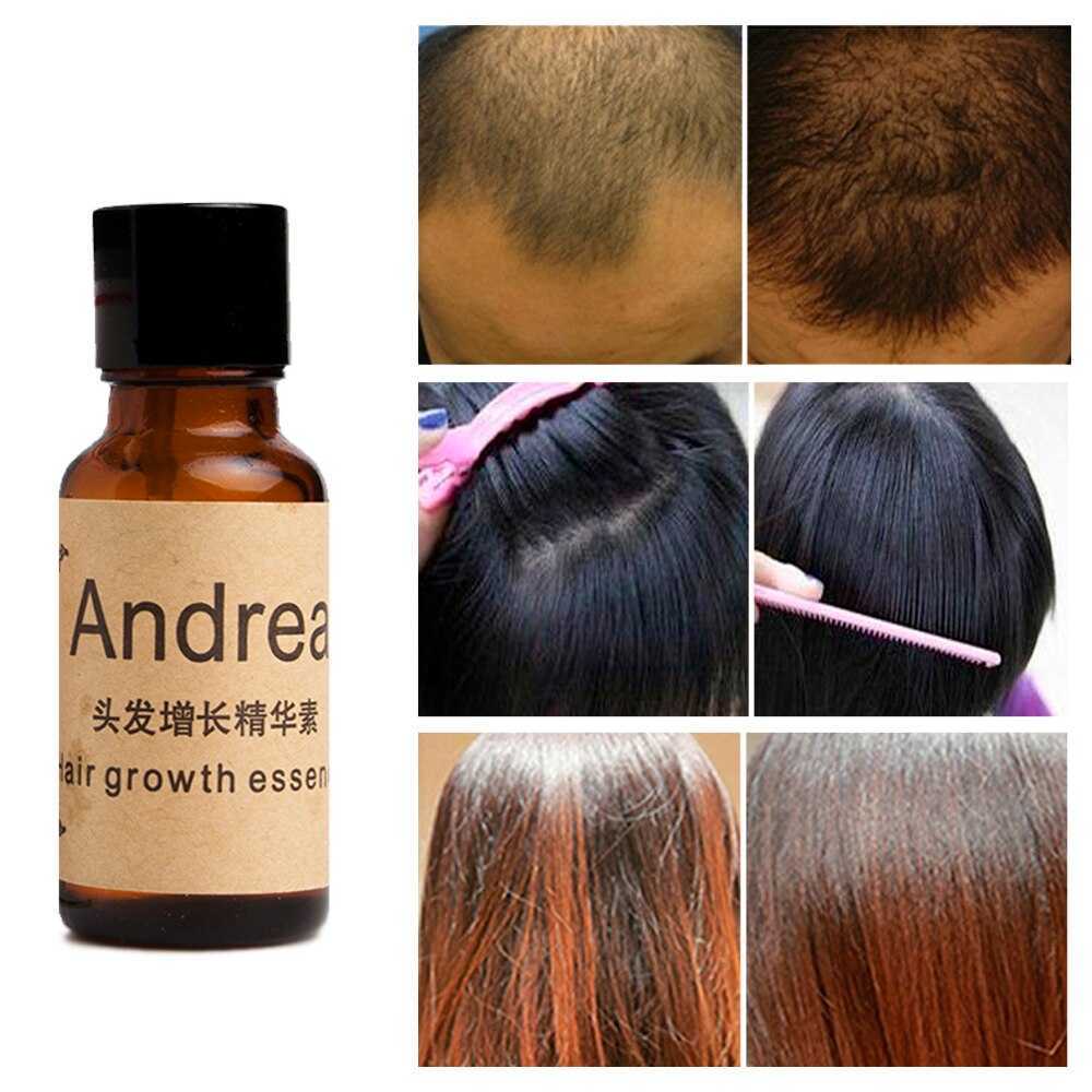 Andrea для роста волос: отзывы, способ применения, инструкция по использованию, состав, показания и противопоказания - luv.ru