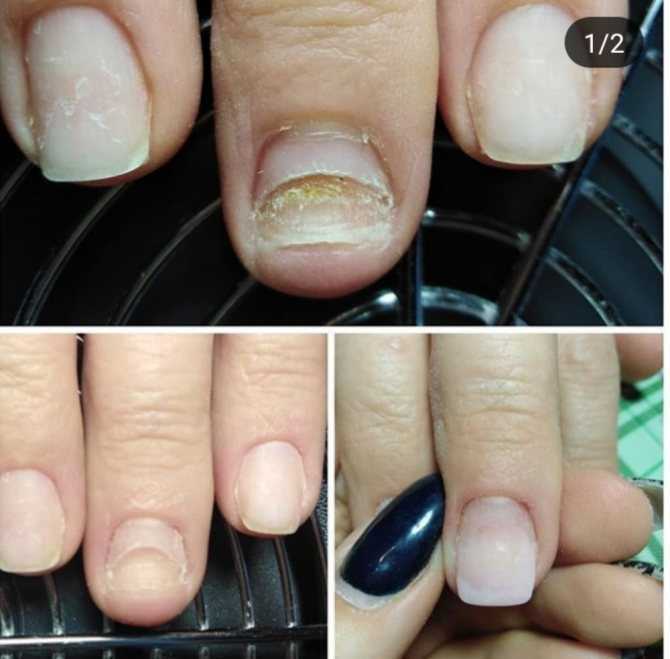 Как восстановить ногти после гель-лака: эффективные способы укрепления ногтевой пластины в домашних условиях