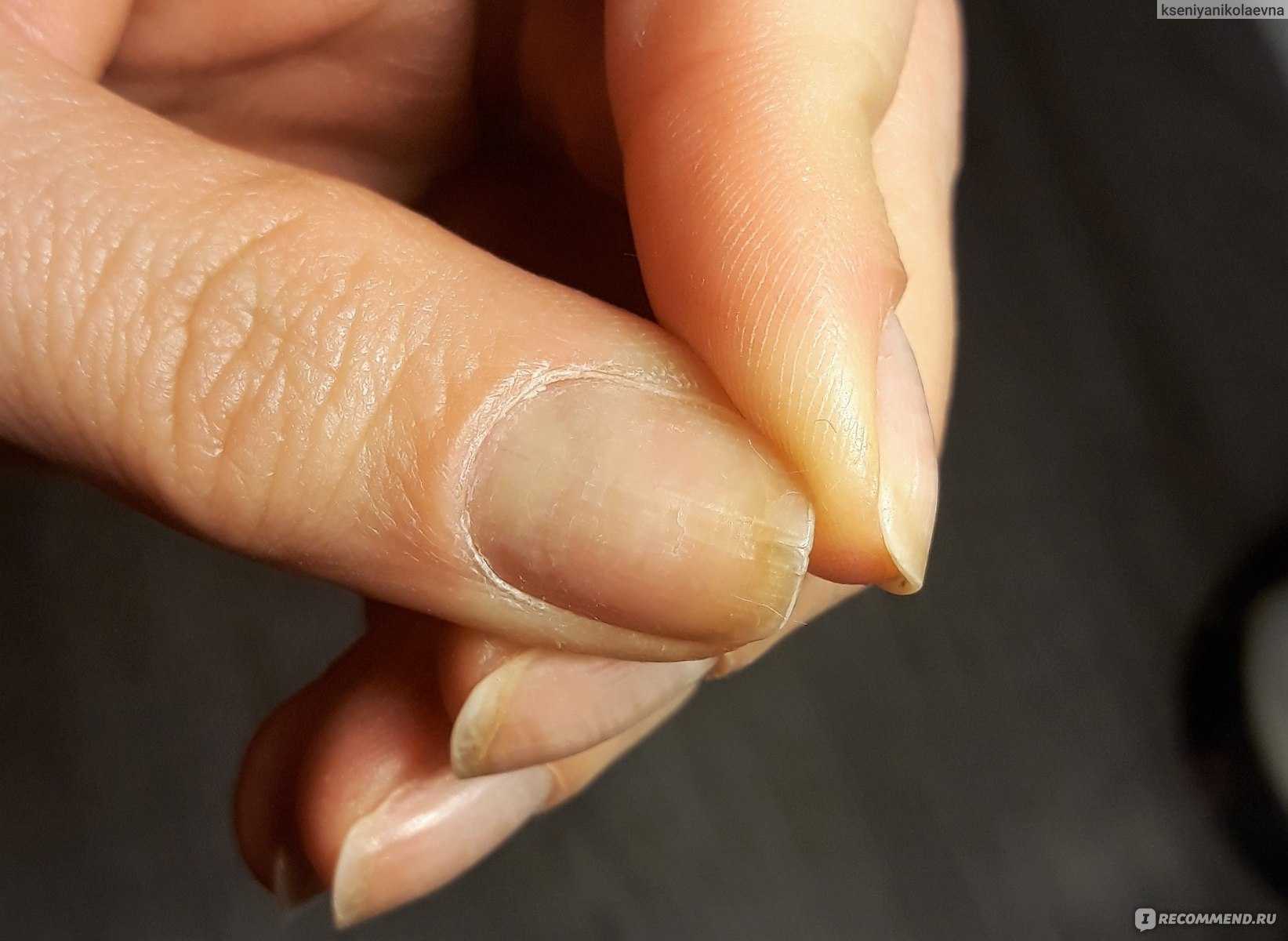 Почему шеллак не держится на ногтях долго: основные причины и рекомендации