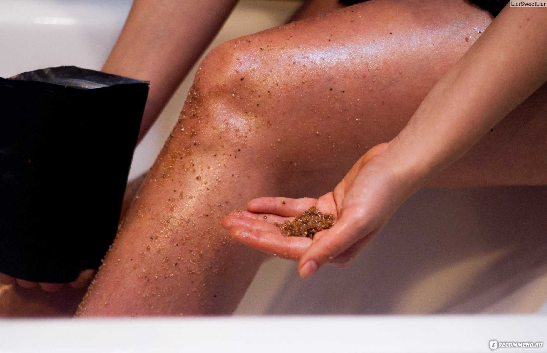 Уход за кожей при псориазе: гигиенические процедуры, косметические средства, образ жизни