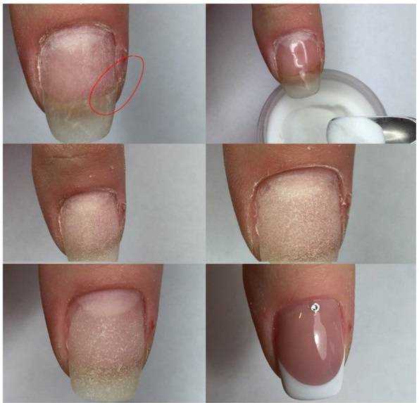 Как укреплять ногти акриловой пудрой под гель лак: пошагово, отзывы
укрепление ногтей акриловой пудрой — modnayadama