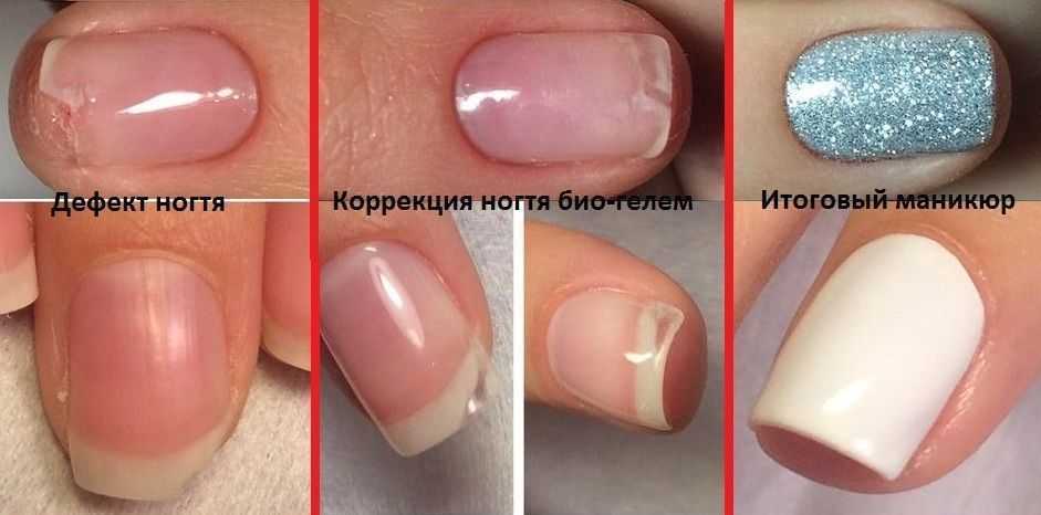 Укрепление ногтей под гель-лак: как укрепить ногти акриловой пудрой, базой, гелем, акрилатиком, полигелем? зачем укреплять ногти под гель-лак?
