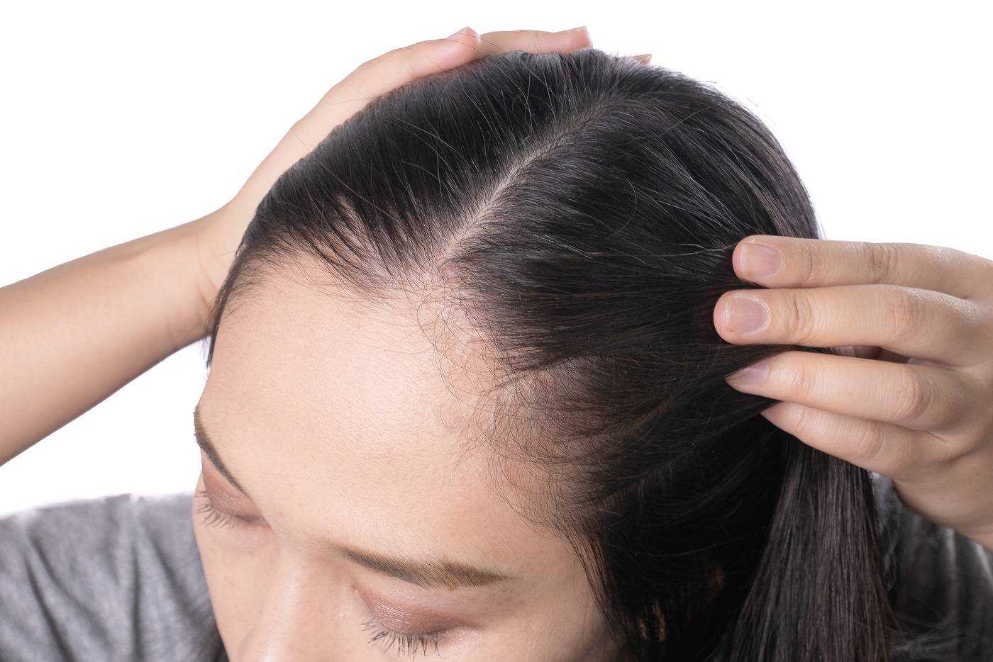 Причины выпадения волос — почему выпадают волосы на голове - клиника «доктор волос»