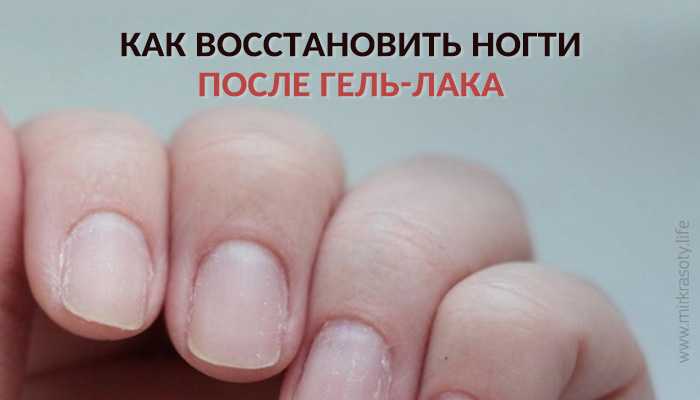 Как восстановить ногти после гель-лака в домашних условиях?