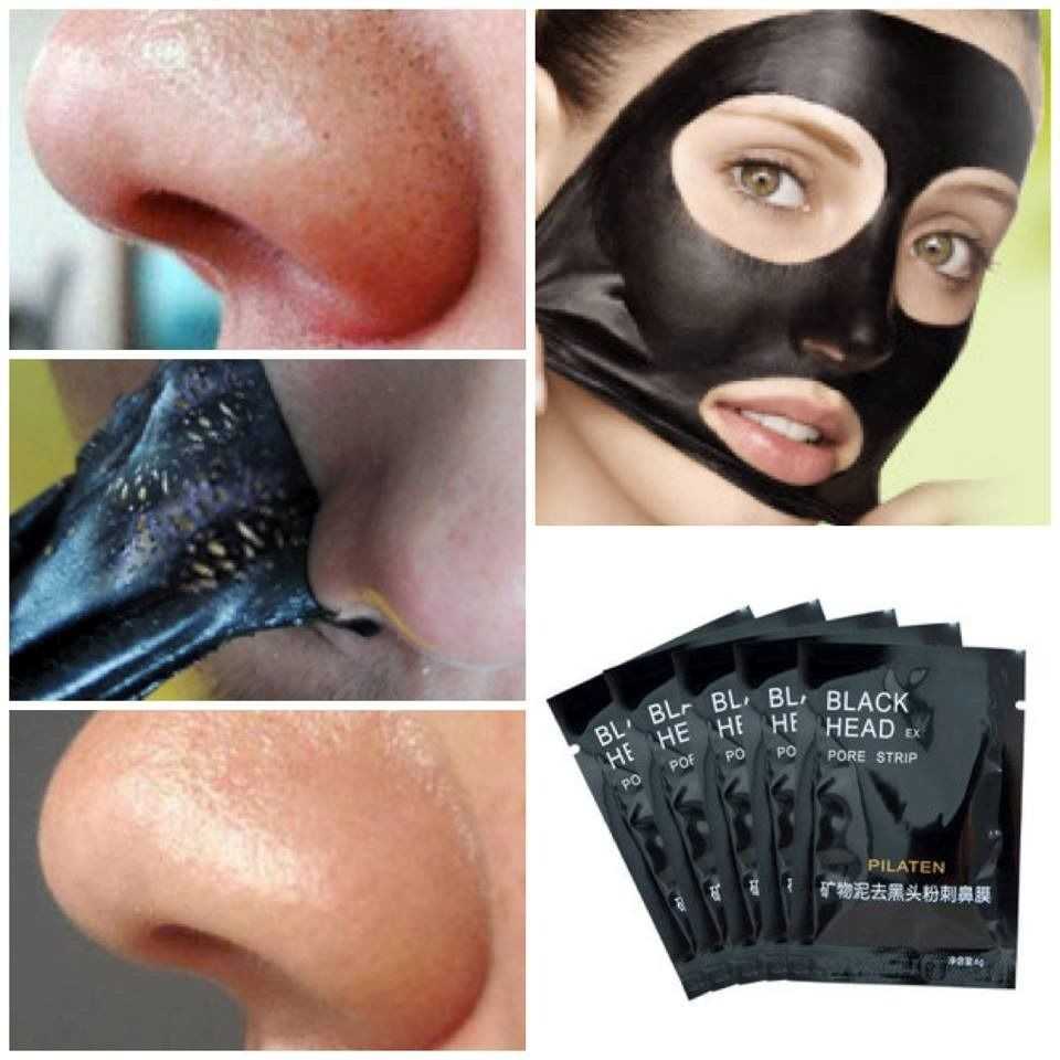 Черная маска для лица от черных точек | лечение акне гелем азелик