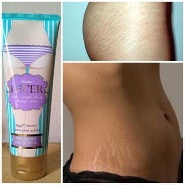 Масло ши: полезные свойства для кожи лица и тела, применение карите в косметологии и медицине