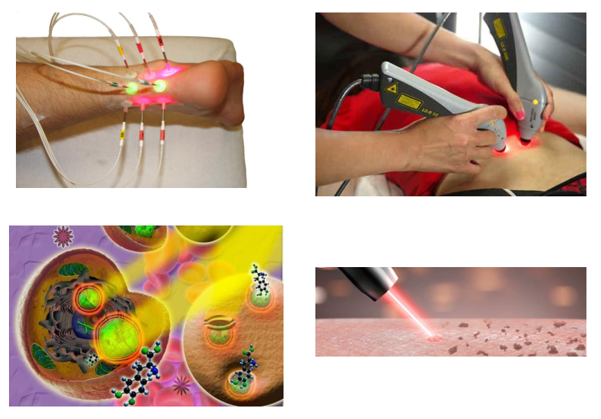 Лазерное омоложение и лечение кожи новейшим лазером mediostar nеxt pro в клинике «золотое сечение»