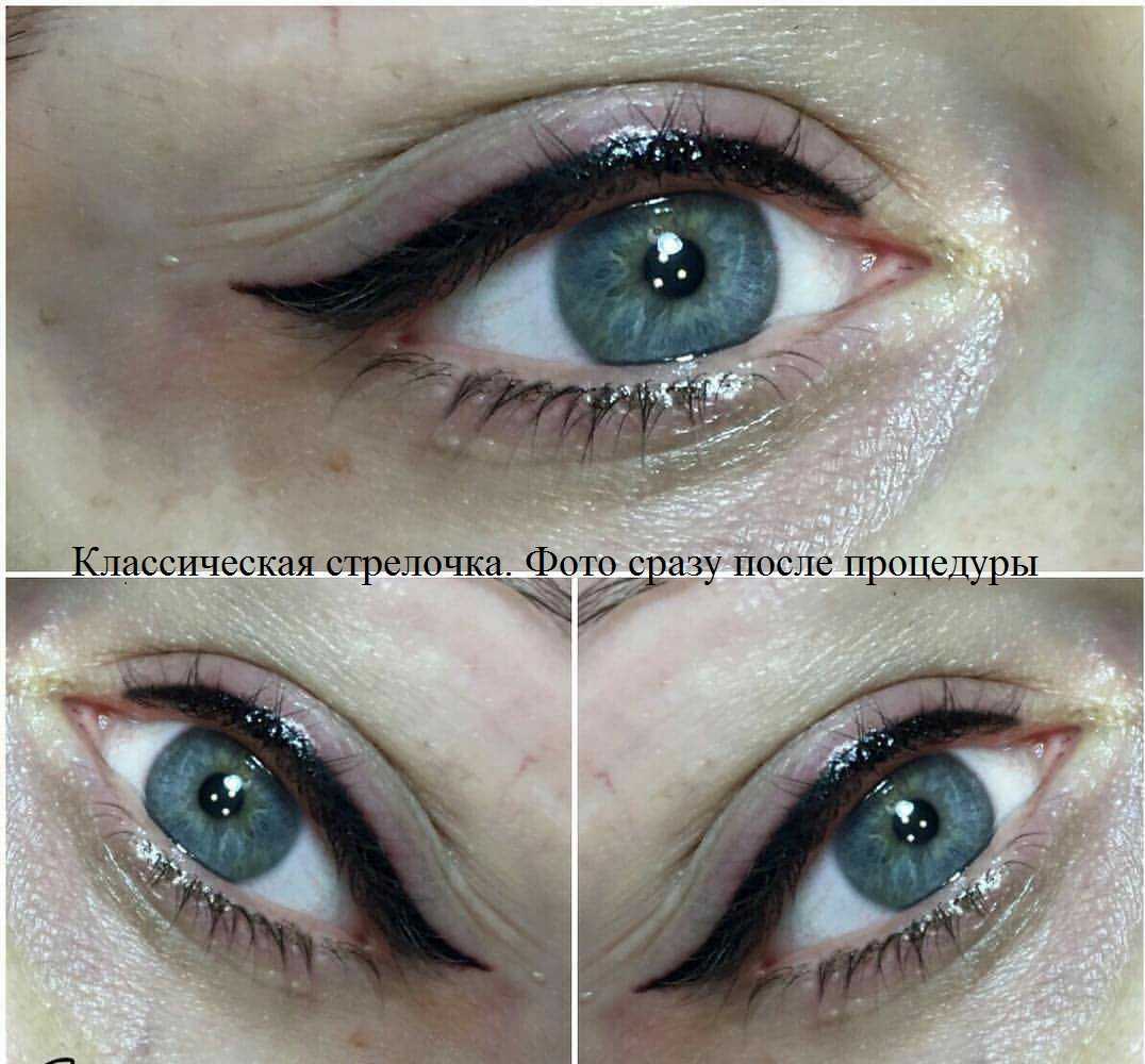 Межресничный татуаж глаз: фото век до и после, противопоказания