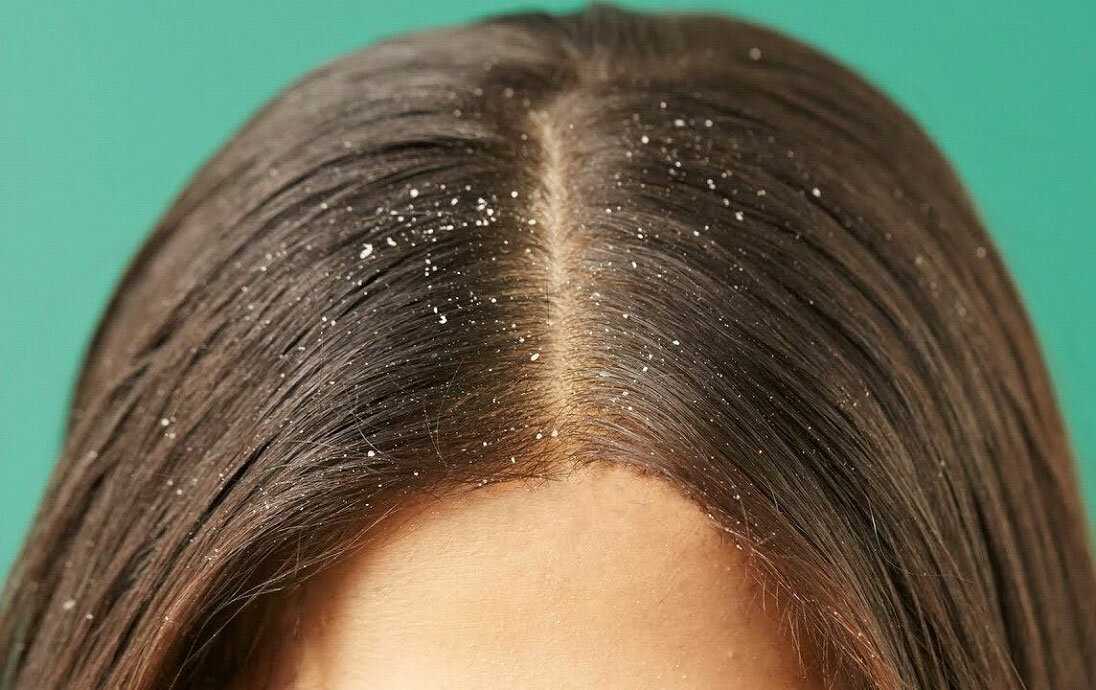 Дегтярное мыло для волос: отзывы о применении