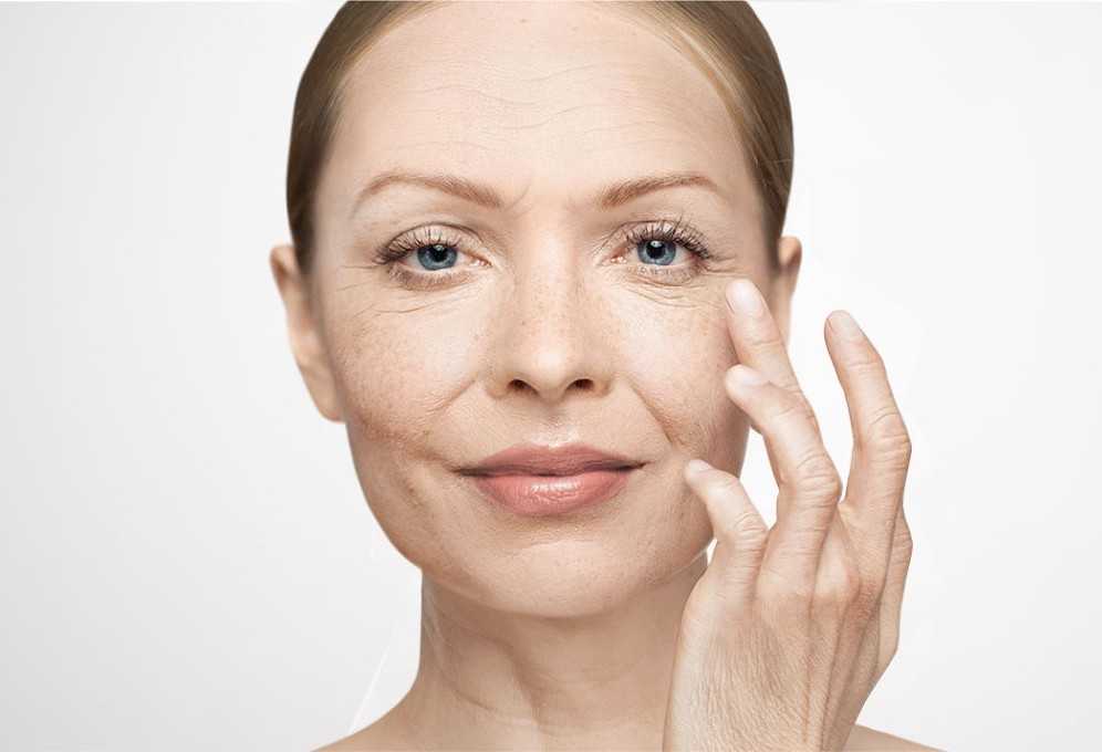 Уход за кожей при псориазе: гигиенические процедуры, косметические средства, образ жизни