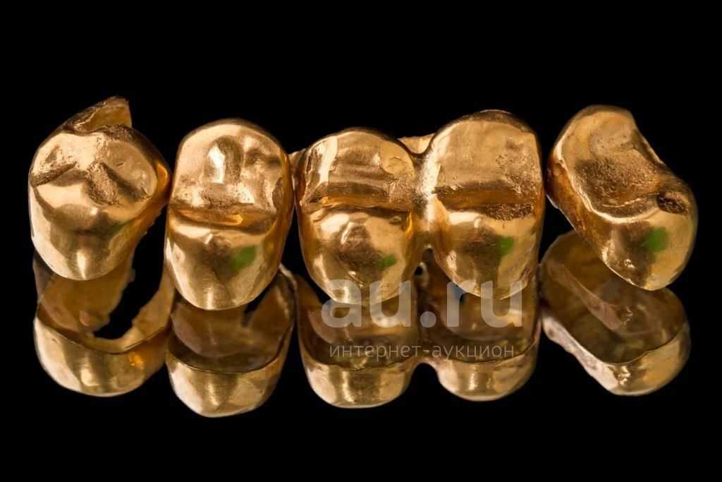 Медицинское золото как альтернатива драгоценным металлам: разнообразие мед сплавов, состав, широкое использование, преимущества и недостатки украшений под золото, отзывы